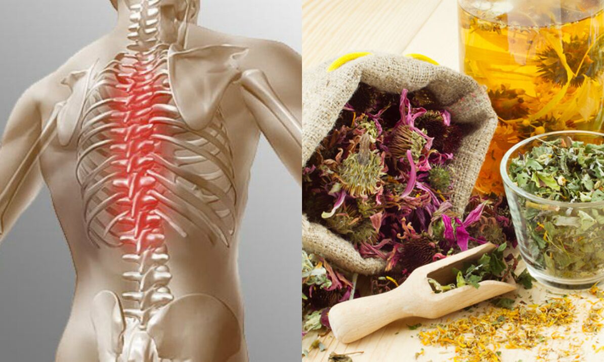 osteochondrosis of the neck by folk methods
